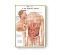 Cuadro de patología, carteles enfermedades anatómicas e impresiones, lienzo, pintura artística, cuadros pared for decoración sala estar, del hogar(L,40X60cm No Frame)