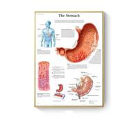 Cuadro de patología, carteles enfermedades anatómicas e impresiones, lienzo, pintura artística, cuadros pared for decoración sala estar, del hogar(K,50X70cm No Frame)