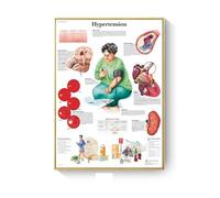 Cuadro de patología, carteles enfermedades anatómicas e impresiones, lienzo, pintura artística, cuadros pared for decoración sala estar, del hogar(F,60X80cm No Frame)