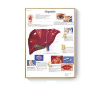 Cuadro de patología, carteles enfermedades anatómicas e impresiones, lienzo, pintura artística, cuadros pared for decoración sala estar, del hogar(N,40X50cm No Frame)