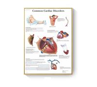 Cuadro de patología, carteles enfermedades anatómicas e impresiones, lienzo, pintura artística, cuadros pared for decoración sala estar, del hogar(C,15X20cm No Frame)