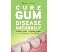 Cure Gum Disease Naturally: Heal Gingivitis and Periodontal Disease with Whole Foods