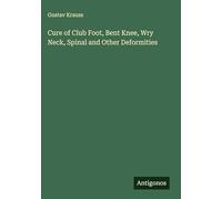Cure of Club Foot, Bent Knee, Wry Neck, Spinal and Other Deformities