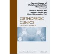 Current Status Of Metal-on-metal Hip Resurfacing An Issue Of Orthopedi