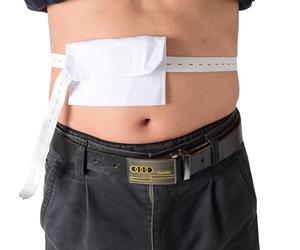 CUSMA Cinturón De Diálisis Peritoneal, Protección del Tubo Peritoneal Ajustable con Cierre De Catéter De Diálisis con Botón Ajustable,Blanco
