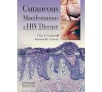 Cutaneous Manifestations Of Hiv Disease