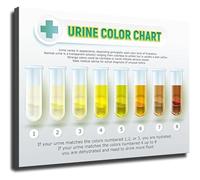 CZMDKEXM Urine Color Health Chart Hydration Reference Poster for Doctor Office Patient Education(Framed,08x12inch(20x30cm))