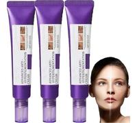 Dark Spot Correcting Glow Serum, crema para eliminar manchas de pigmento, tratamiento de hiperpigmentación, eliminador de manchas oscuras para la cara, tratamiento del melasma para la cara, para todos