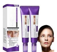 Dark Spot Correcting Glow Serum, crema para eliminar manchas de pigmento, tratamiento de hiperpigmentación, eliminador de manchas oscuras para la cara, tratamiento del melasma para la cara, para todos