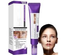 Dark Spot Correcting Glow Serum, crema para eliminar manchas de pigmento, tratamiento de hiperpigmentación, eliminador de manchas oscuras para la cara, tratamiento del melasma para la cara, para todos