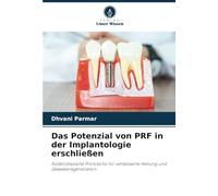 Das Potenzial von PRF in der Implantologie erschließen: Evidenzbasierte Protokolle für verbesserte Heilung und Geweberegeneration