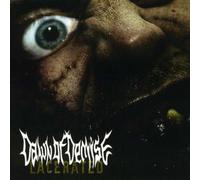 Dawn Of Demise - Lacerated