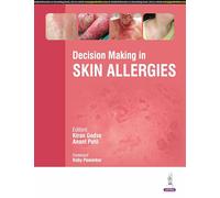 Decision Making in Skin Allergies