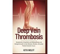 Deep Vein Thrombosis: Symptome, Ursachen und Behandlung von Blutgerinnseln in den Beinen, Risiken, die jeder Patient kennen muss