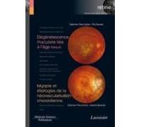 Dégénérescence Maculaire Liée À Lâge (dmla) (volume 7 - Coffret Rétine