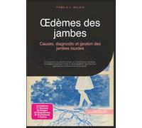 Œdèmes des jambes: Causes, diagnostic et gestion des jambes lourdes (Maladies vasculaires)