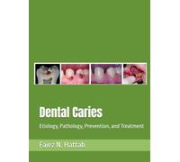 Dental Caries: Etiology, Pathology, Prevention, and Treatment