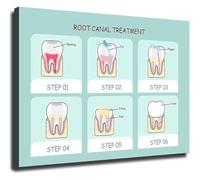 Dental Health Poster Root Canal Treatment Educational Chart for Clinic Office School Home(Framed,16x24inch(40x60cm))