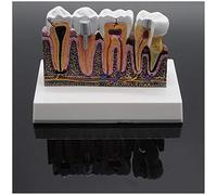 Dentista Disección Educativa Modelo de Dientes, Modelo de Dientes para la Educación - Simulación Oral Diente Diente Modelo de Demostración - Diente Desmontable Modelo Anatómico - para el Estudio de la
