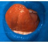 Depth Charge - Blue Lipps