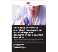 Dermatite de contact allergique provoquée par les vis d'implants dentaires et les appareils dentaires: Étude des réactions d'hypersensibilité aux ... utilisés en dentisterie implantaire