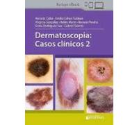 Dermatoscopia: Casos Clinicos 2