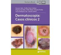 DERMATOSCOPIA CASOS CLINICOS 2