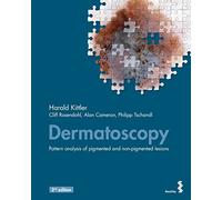 Dermatoscopy: An algorithmic method based on pattern analysis