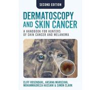 Dermatoscopy and Skin Cancer, second edition: A handbook for hunters of skin cancer and melanoma