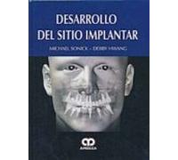 Desarrollo Del Sitio Implantar