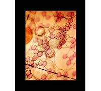 DESINFORMACIÓN Y AUTISMO: La Revolución Silenciosa: De los Mitos a la Ciencia