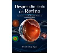 Desprendimiento de Retina: Fundamentos Avanzados, Diagnóstico Multimodal y Tratamiento Integral