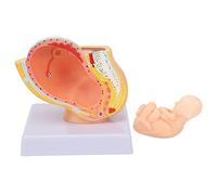 Destrator anatómico de Embarazo, Modelo de Pelvis Maternal de 9 Meses, Herramienta de educación gestacional Desmontable para capacitación clínica médica