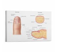 Detailed Human Nail Anatomy Chart Nail Structure Poster Biology Educational Wall-Art for Dermatology Podiatry Clinic Classroom Decor(Framed,12x18inch(30x45cm))