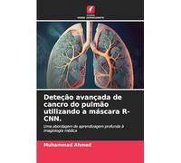 Deteção avançada de cancro do pulmão utilizando a máscara R-CNN.