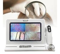 Detector De FolíCulos Pilosos, Cuero Cabelludo Y Piel, Con Pantalla De 11 Pulgadas, Equipo De Prueba Del Cuero Cabelludo Con Cabezales Dobles 50X/200X, Para PeluqueríAs, Spa