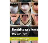 Diagnóstico por la lengua: Medicina China