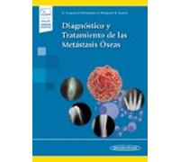 Diagnostico y tratamiento de las metastasis oseas (incluye versión digital)