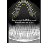 DIAGRAMA INDIVIDUAL TRIDIMENSIONAL:: DESENVOLVIMENTO DE TÉCNICA (FUNDAMENTOS DA ORTODONTIA)