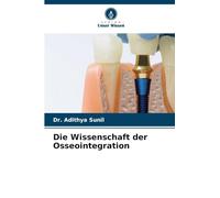 Die Wissenschaft der Osseointegration