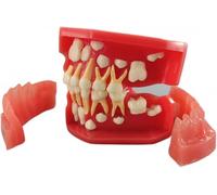 Dientes Typodonts Modo Dental 3-12 Años Constante Dientes Crecen Reemplazar Demo Anatomía Enseñanza Estudio(7012)