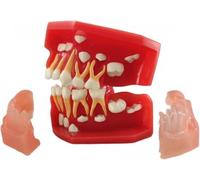 Dientes Typodonts Modo Dental 3-12 Años Constante Dientes Crecen Reemplazar Demo Anatomía Enseñanza Estudio(7011)