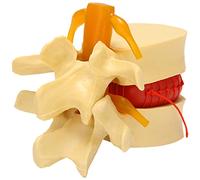 Diheohg Modelo de vértebra lumbar vértebras anatómicas columnas lumbares vértebras discos prolapso anatomía material didáctico lumbar modelo de vértebra