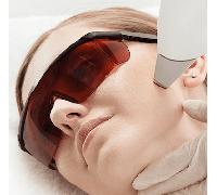 Diodenlaser - Gesichts komplett + Hals
