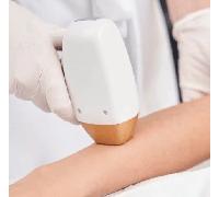 Diodenlaser - Unterarme