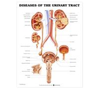 Diseases of the Urinary Tract Anatomical Chart