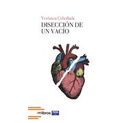 DISECCIÓN DE UN VACÍO: 308 (ITES)