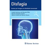 DISFAGIA: EXAMES POR IMAGEM EM REALIDADE AUMENTADA