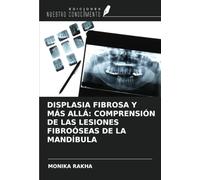 DISPLASIA FIBROSA Y MÁS ALLÁ: COMPRENSIÓN DE LAS LESIONES FIBROÓSEAS DE LA MANDÍBULA