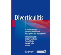Diverticulitis: A Comprehensive, Evidence-Based Guide to Diagnosis and Management